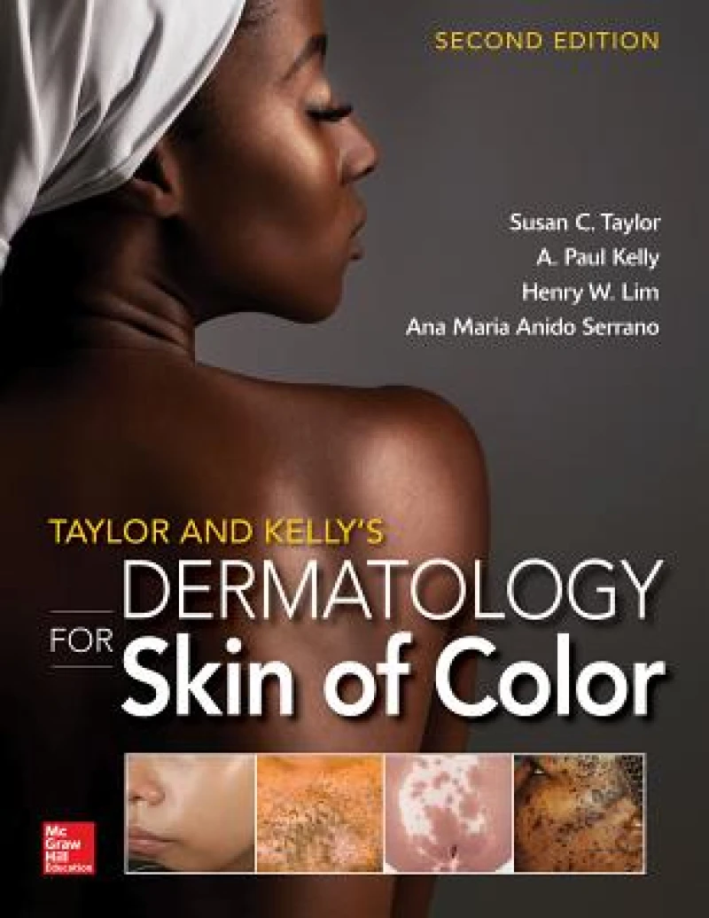 Taylor and Kelly's Dermatology for Skin of Color 2/E