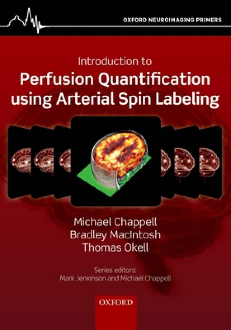 Introduction to Perfusion Quantification using Arterial Spin Labelling