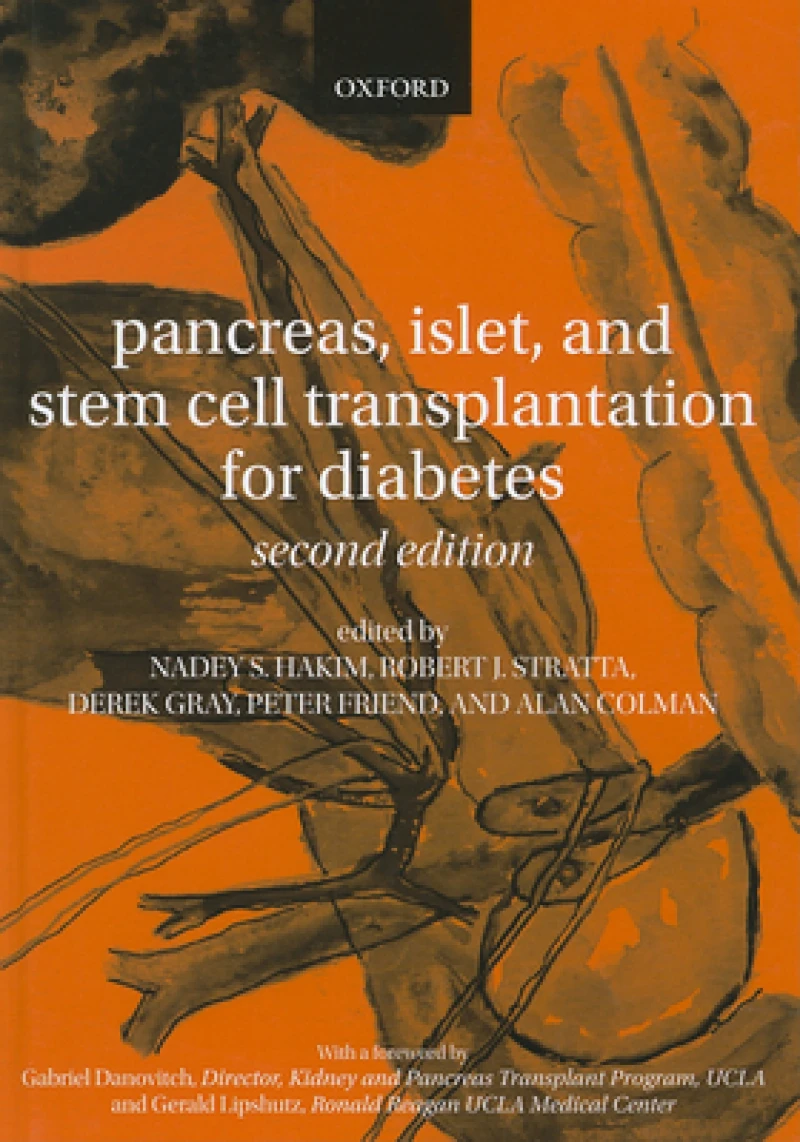 Pancreas, Islet and Stem Cell Transplantation for Diabetes