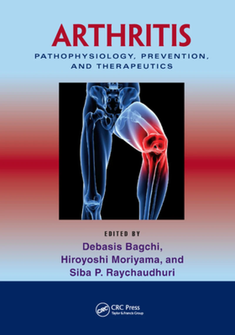 Arthritis