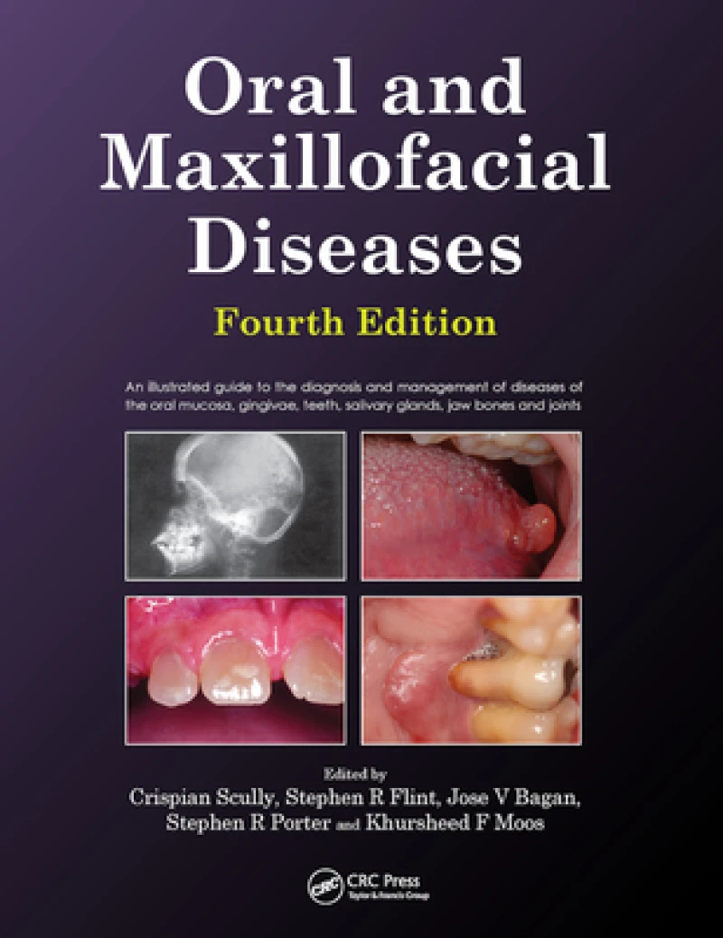 Oral and Maxillofacial Diseases, Fourth Edition
