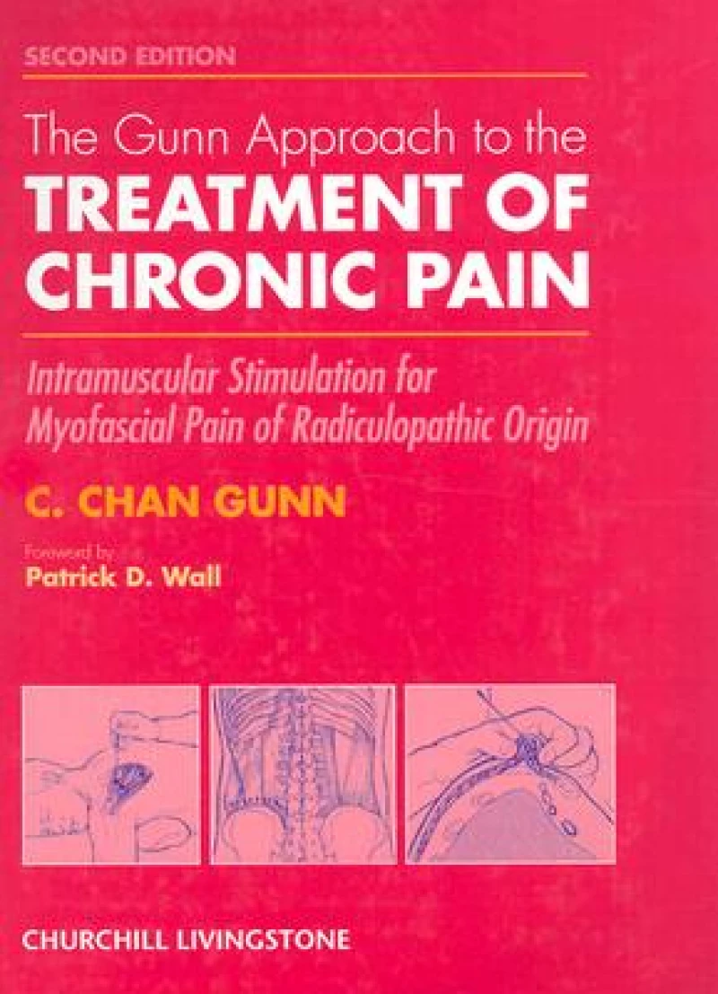 The Gunn Approach to the Treatment of Chronic Pain