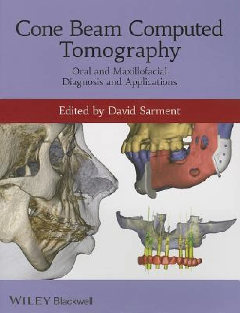 Cone Beam Computed Tomography