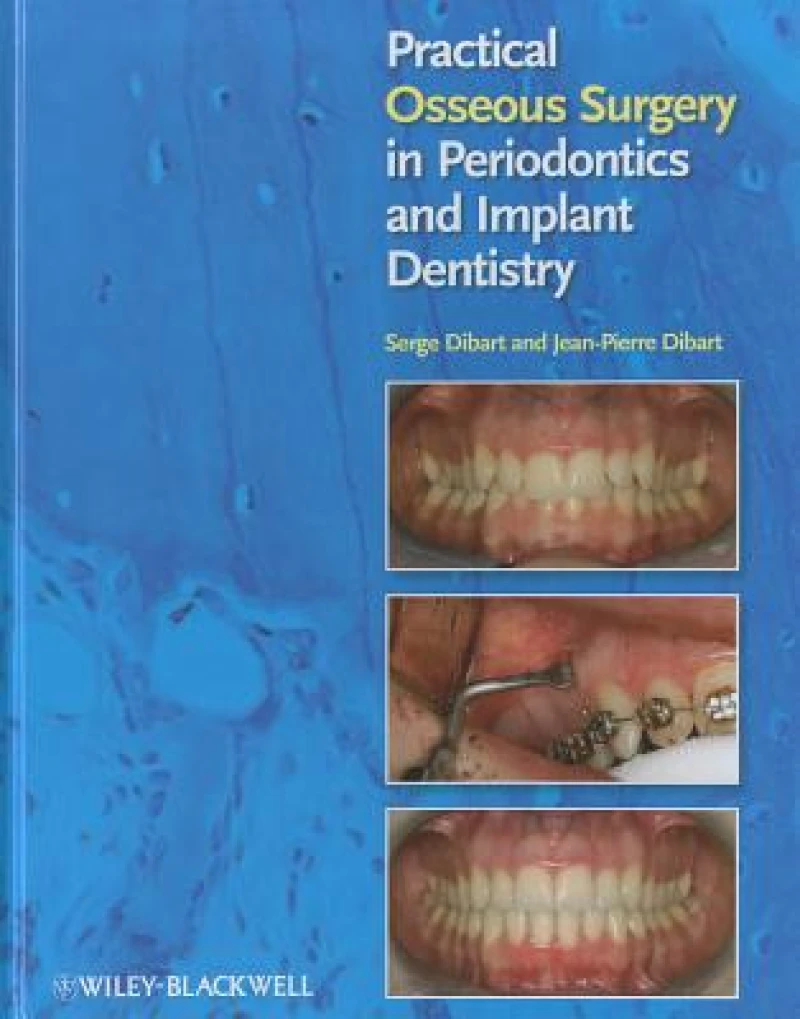 Practical Osseous Surgery in Periodontics and Implant Dentistry