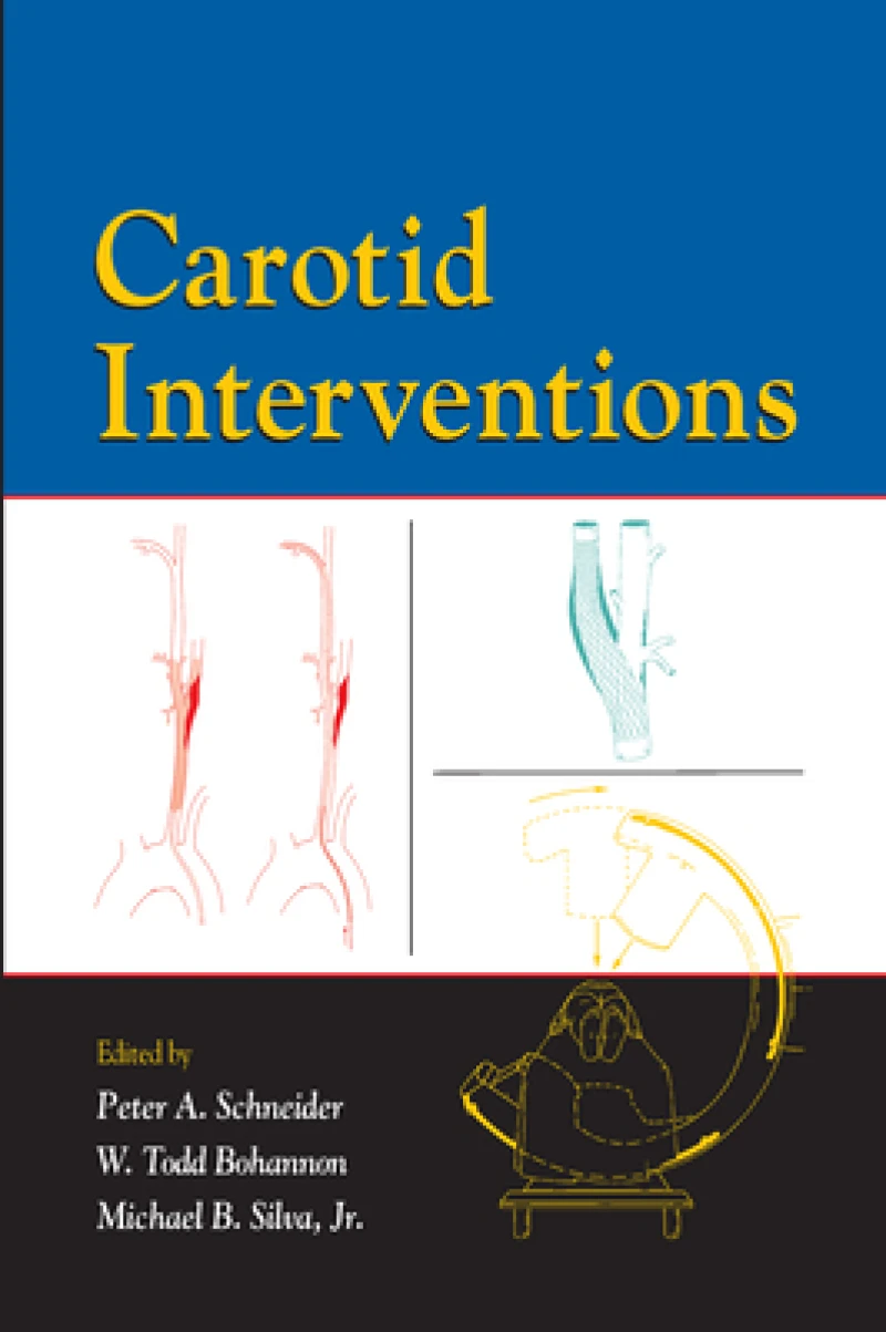 Carotid Interventions