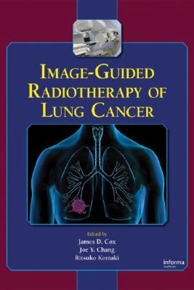 Image-Guided Radiotherapy of Lung Cancer