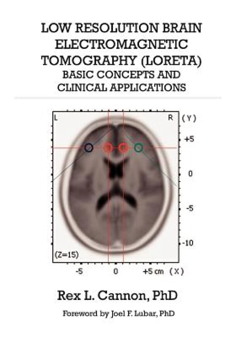 Low Resolution Brain Electromagnetic Tomography (LORETA)