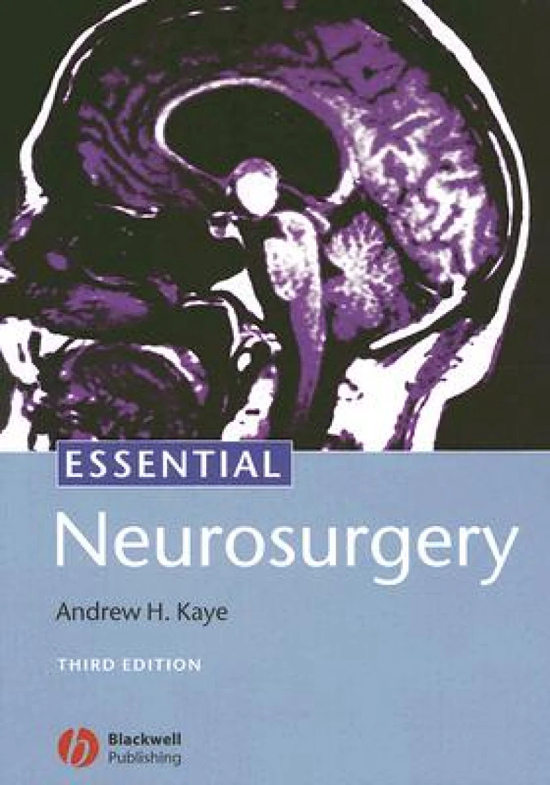 Essential Neurosurgery