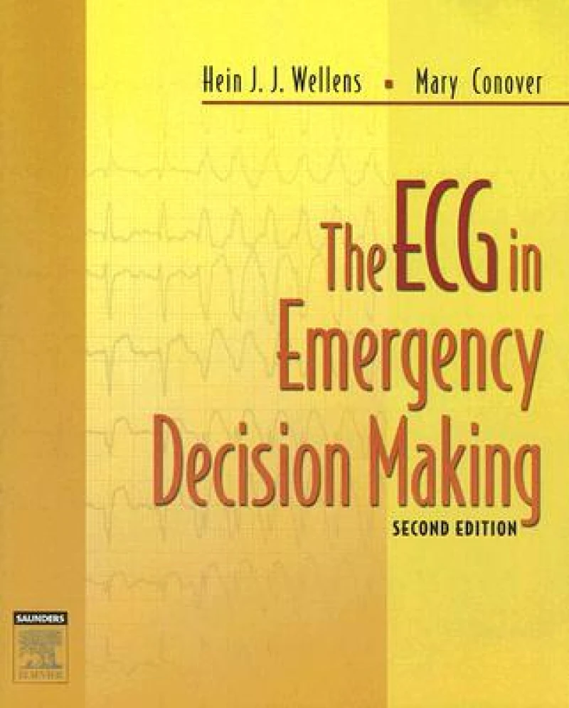 The ECG in Emergency Decision Making
