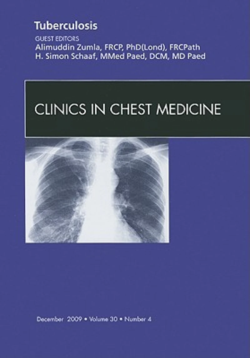 Tuberculosis, An Issue of Clinics in Chest Medicine