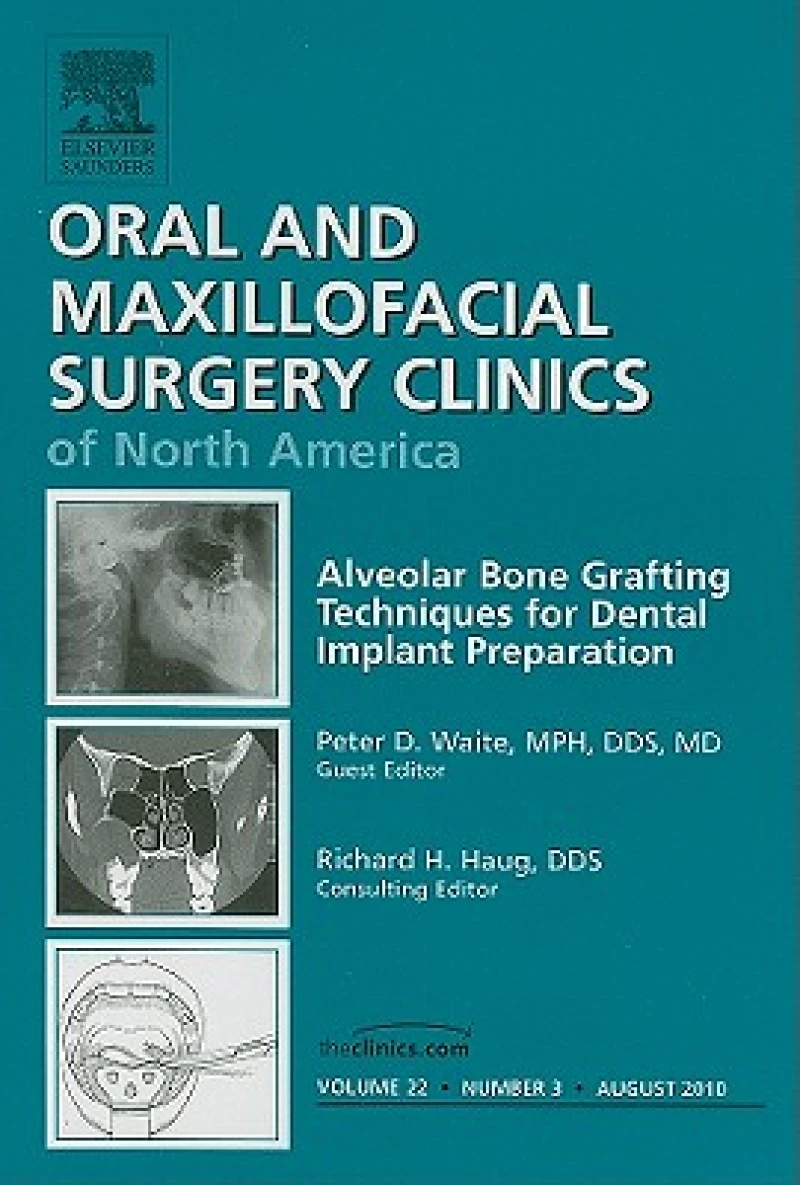 Alveolar Bone Grafting Techniques for Dental Implant Preparation, An Issue of Oral and Maxillofacial Surgery Clinics