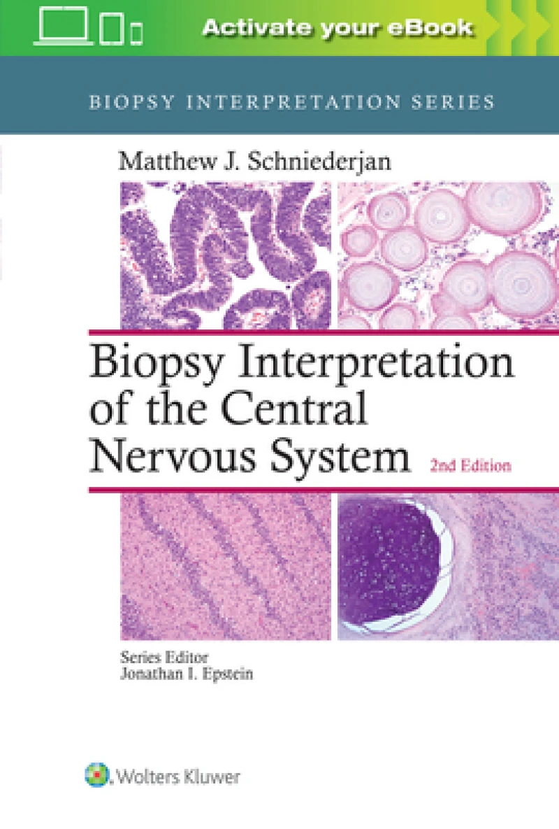 Biopsy Interpretation of the Central Nervous System