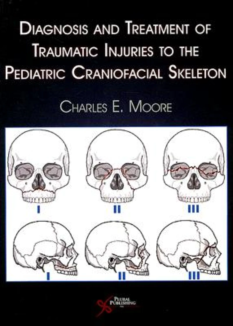 Diagnosis and Treatment of Traumatic Injuries to the Pediatric Craniofacial Skeleton