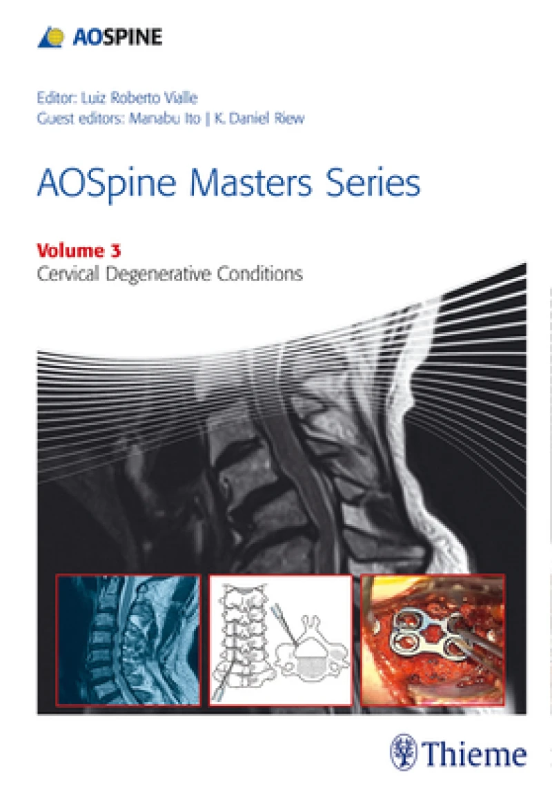 AOSpine Masters Series Volume 3: Cervical Degenerative Conditions