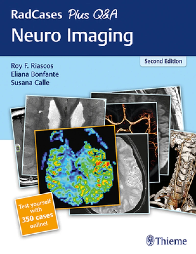 RadCases Plus Q&a Neuro Imaging