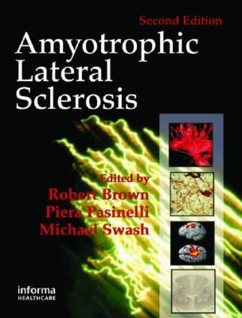 Amyotrophic Lateral Sclerosis, Second Edition