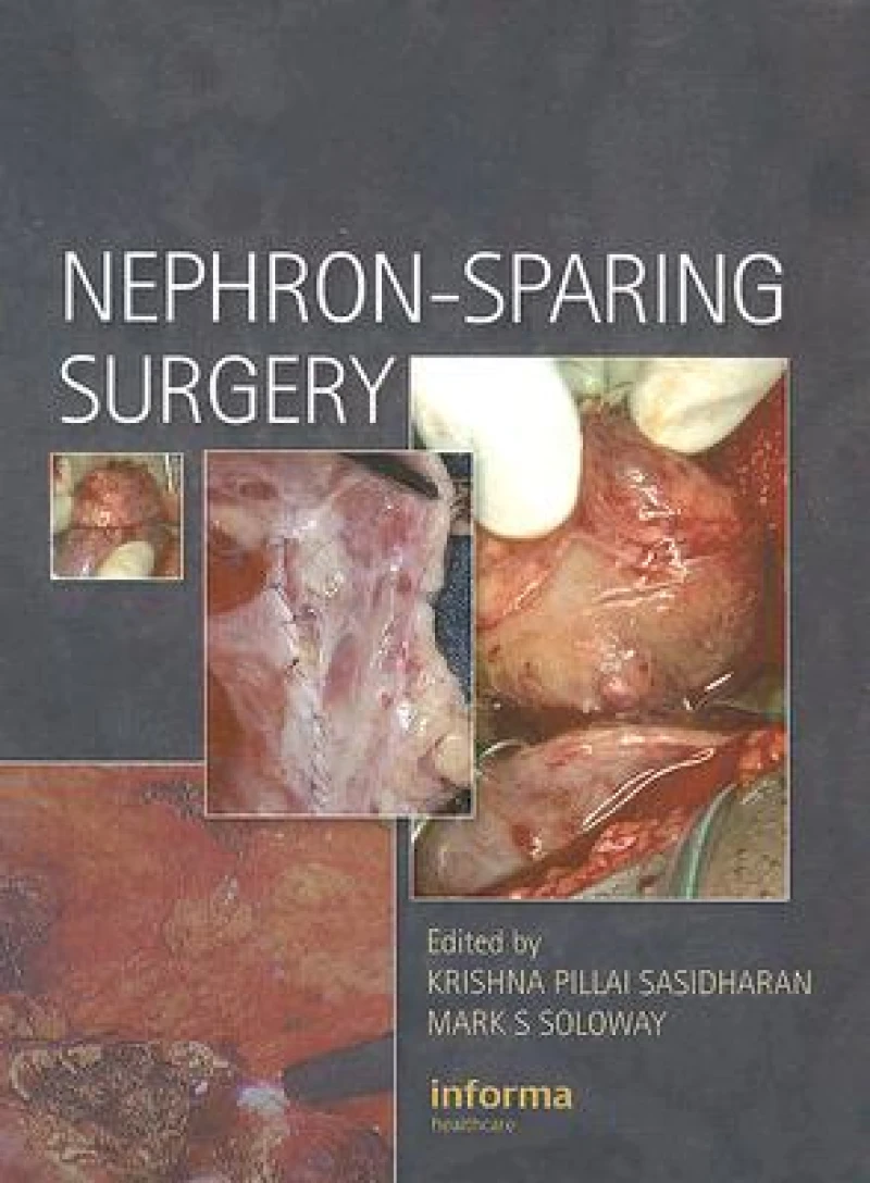 Nephron-Sparing Surgery
