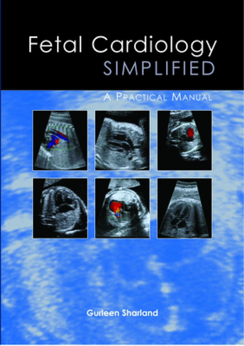 Fetal Cardiology Simplified