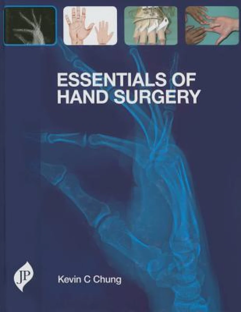 Essentials of Hand Surgery