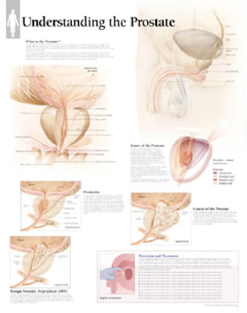 Understanding the Prostate Laminated Poster