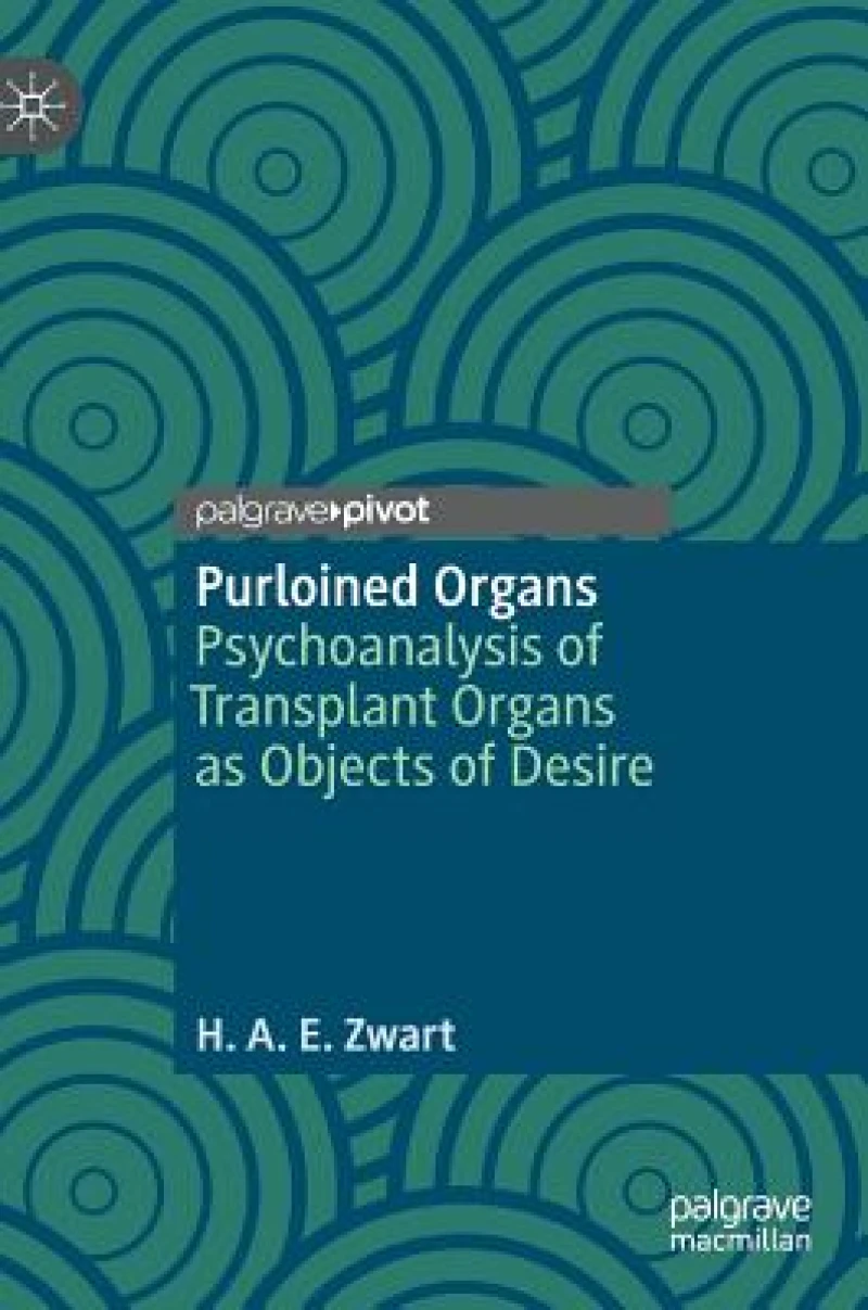 Purloined Organs