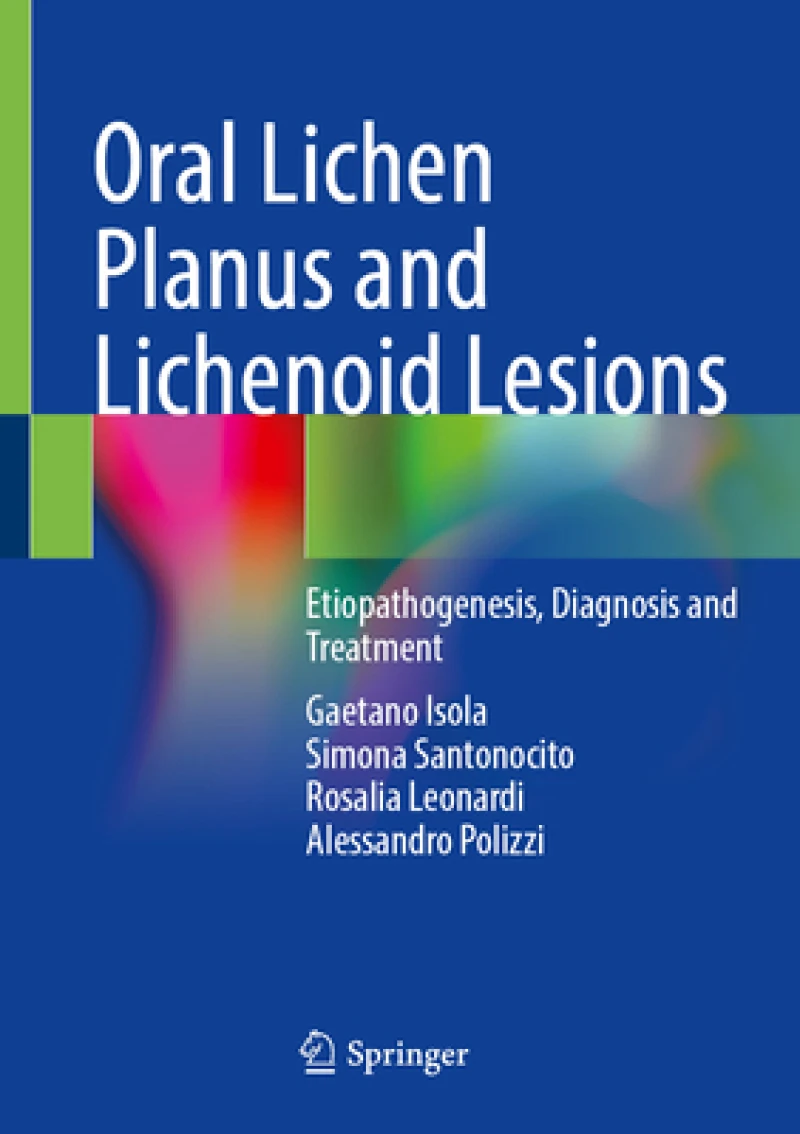 Oral Lichen Planus and Lichenoid Lesions