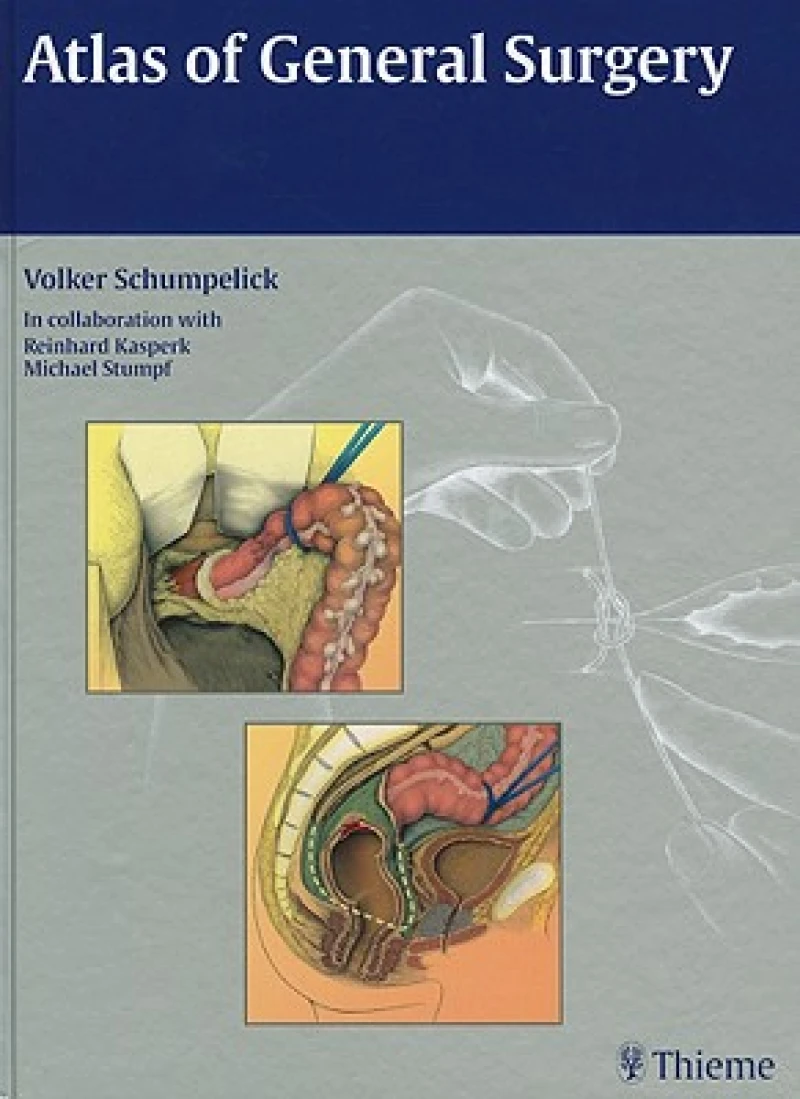 Atlas of General Surgery