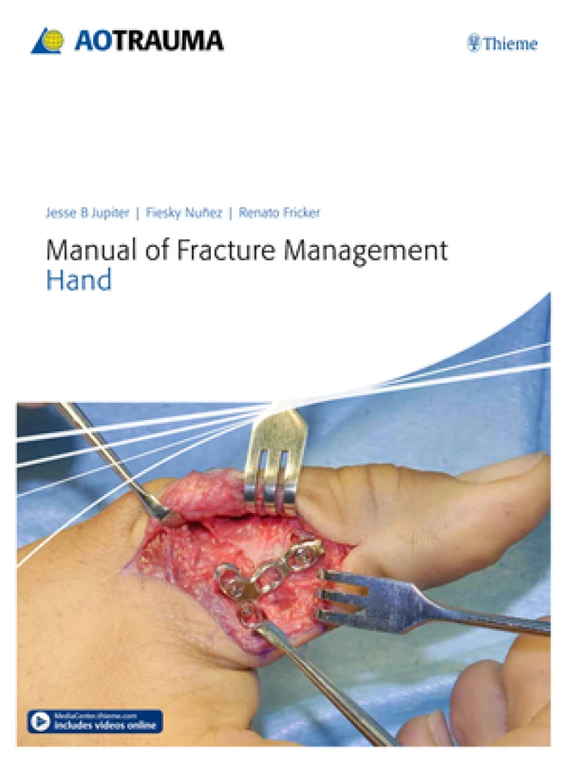 Manual of Fracture Management - Hand