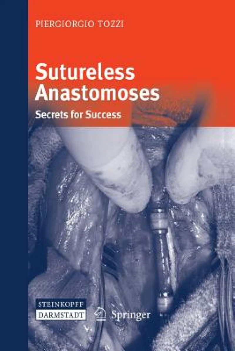 Sutureless Anastomoses