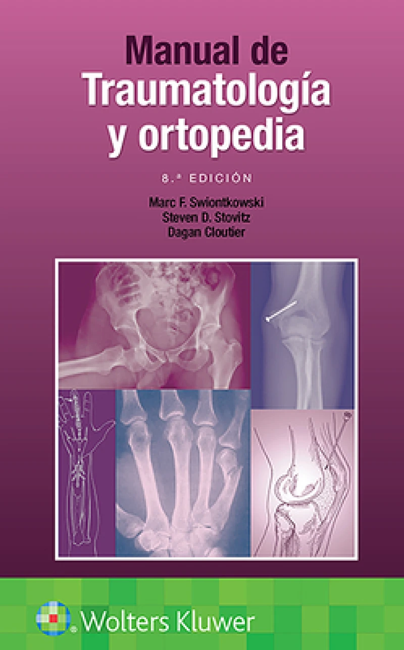 Manual de traumatologia y ortopedia