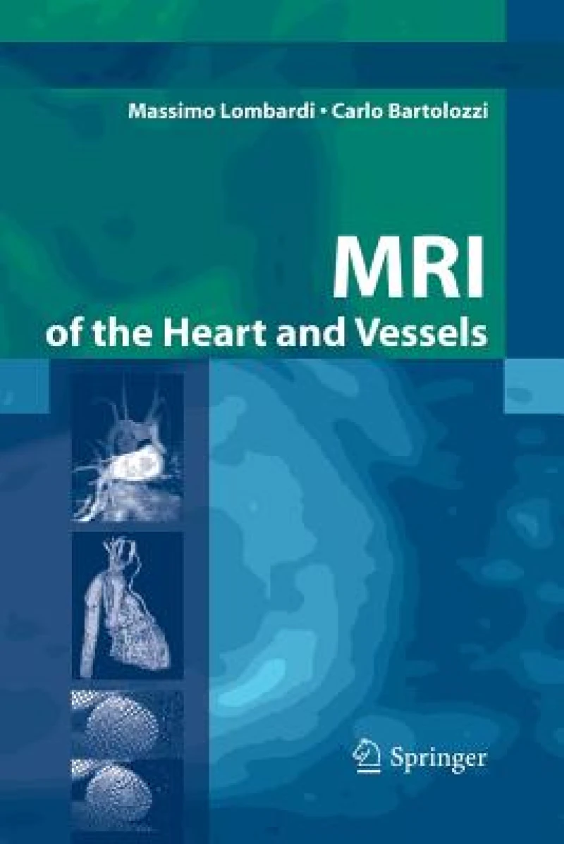 MRI of the Heart and Vessels