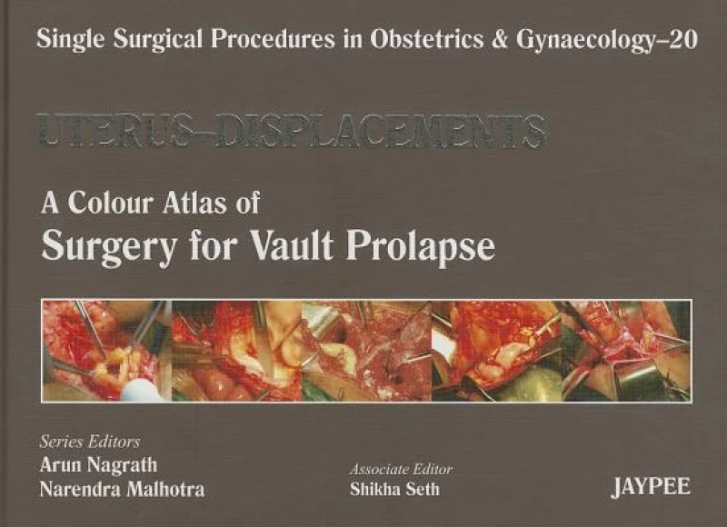 Single Surgical Procedures in Obstetrics and Gynaecology - Volume 20 - UTERUS - DISPLACEMENTS