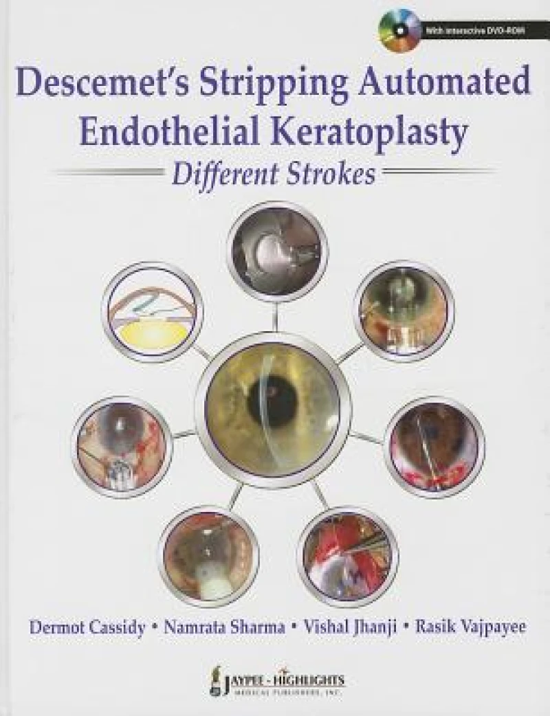 Descemet's Stripping Automated Endothelial Keratoplasty: Different Strokes