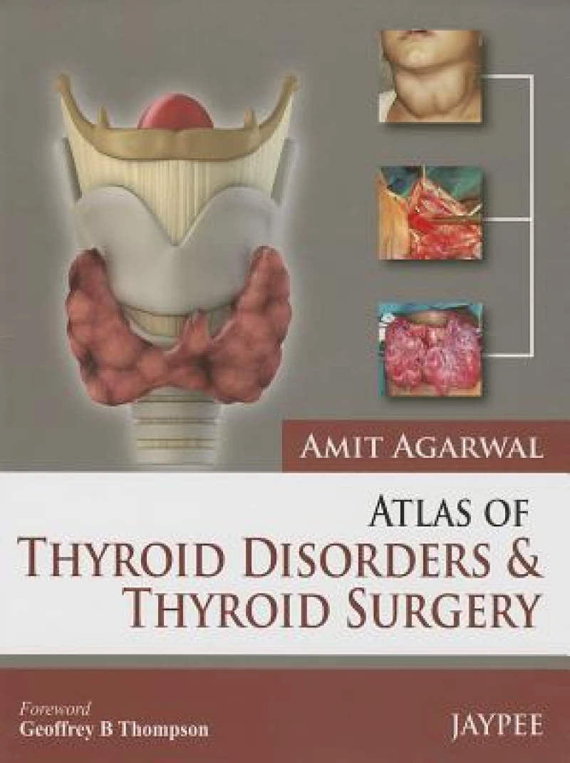 Atlas of Thyroid Disorders and Thyroid Surgery