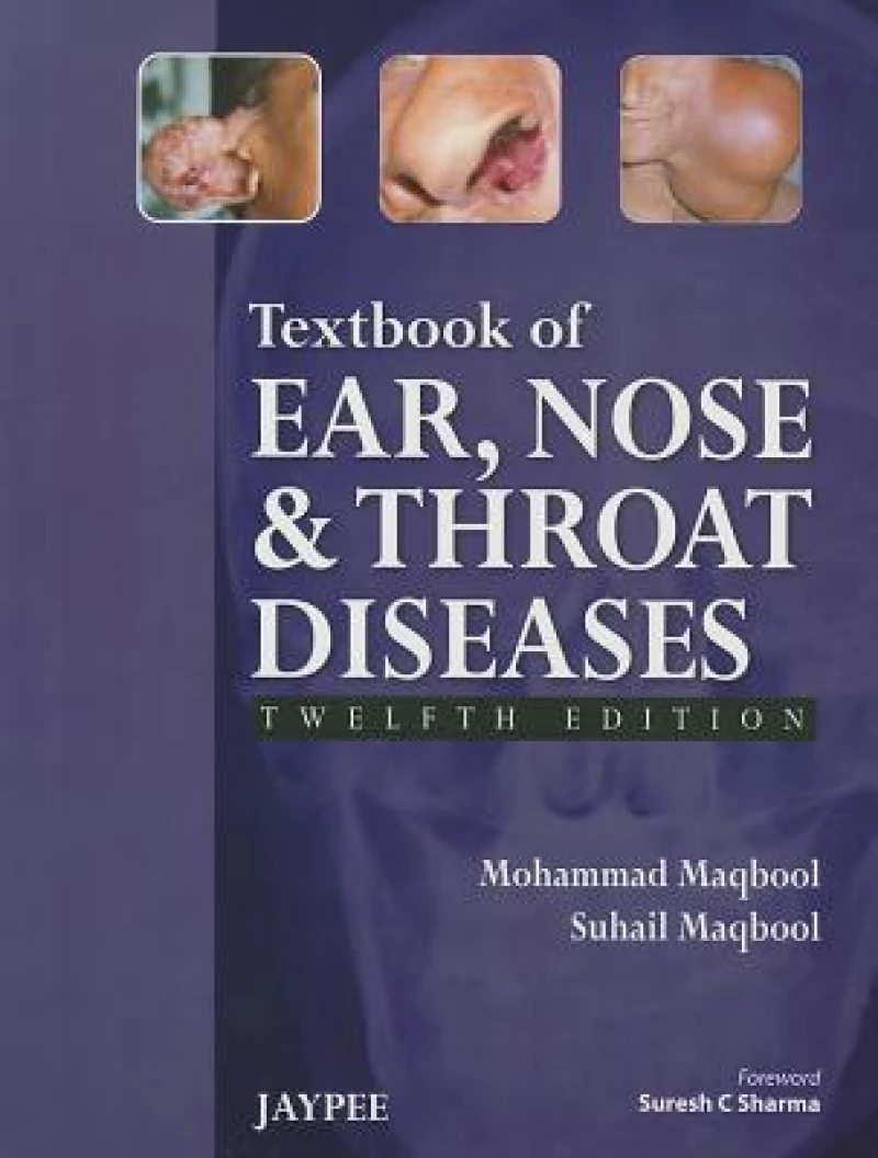 Textbook of Ear, Nose and Throat Diseases