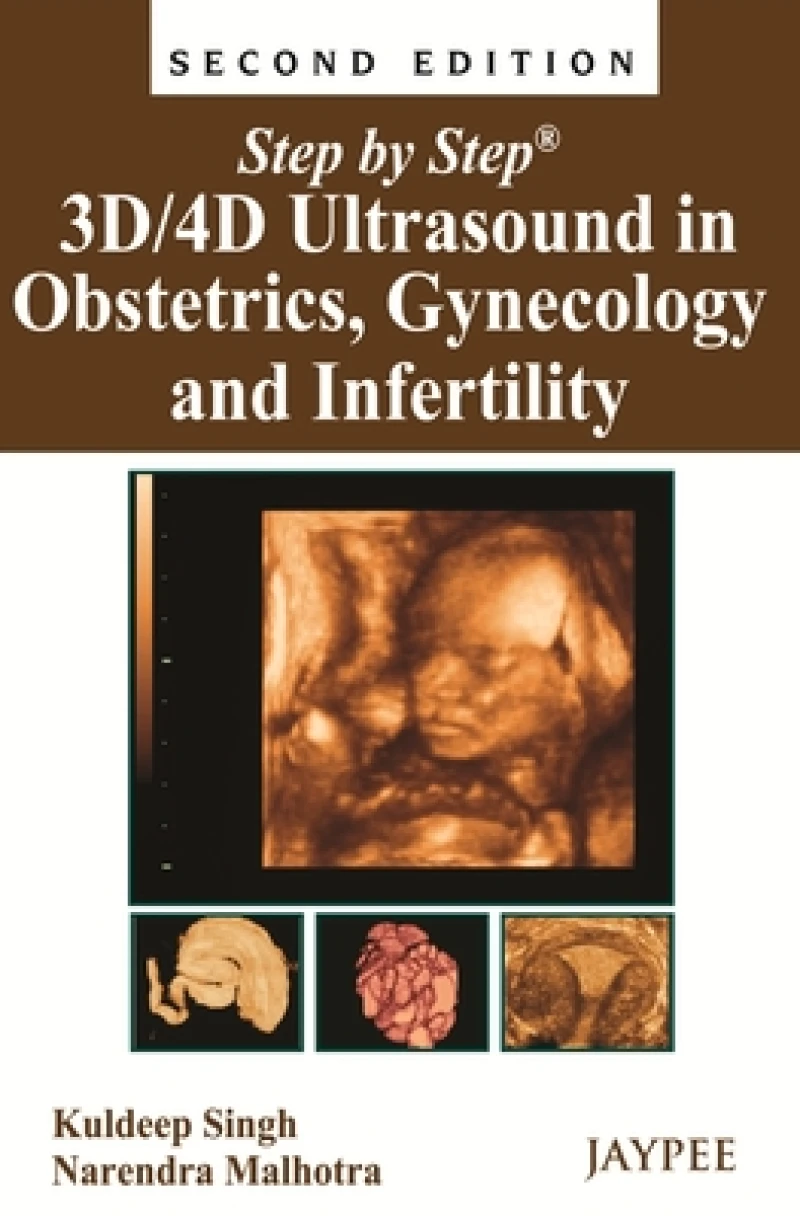 Step by Step: 3D/4D Ultrasound in Obstetrics, Gynecology and Infertility