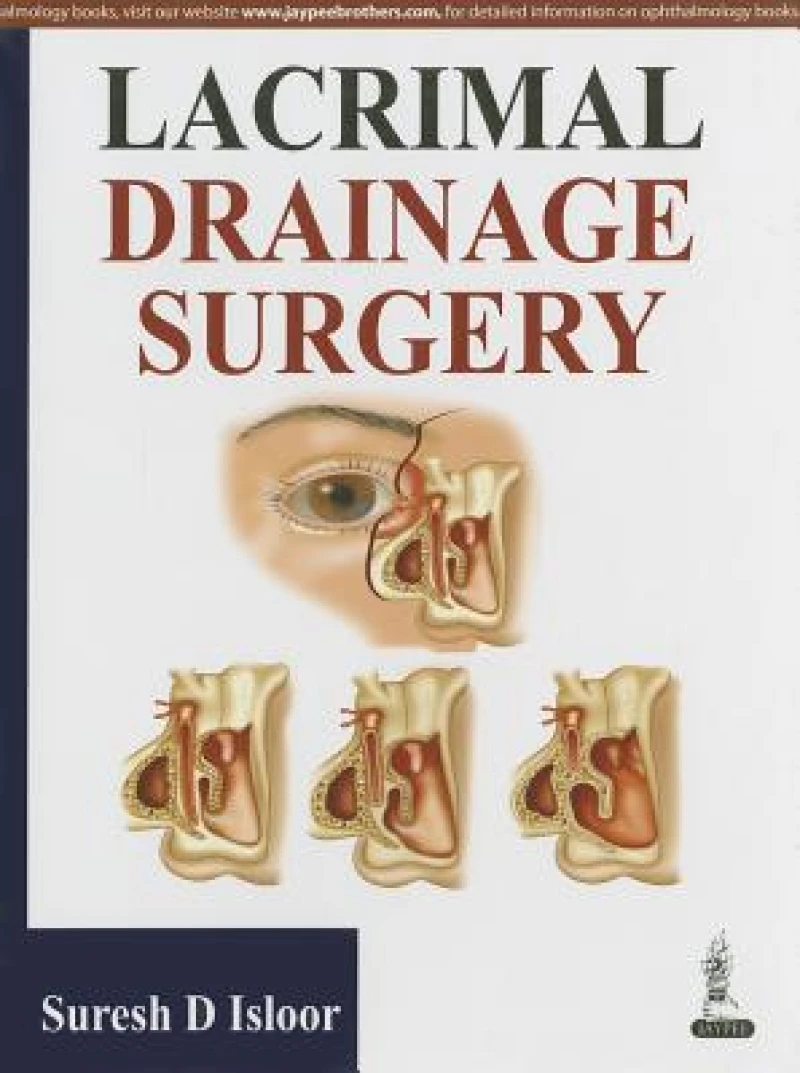 Lacrimal Drainage Surgery