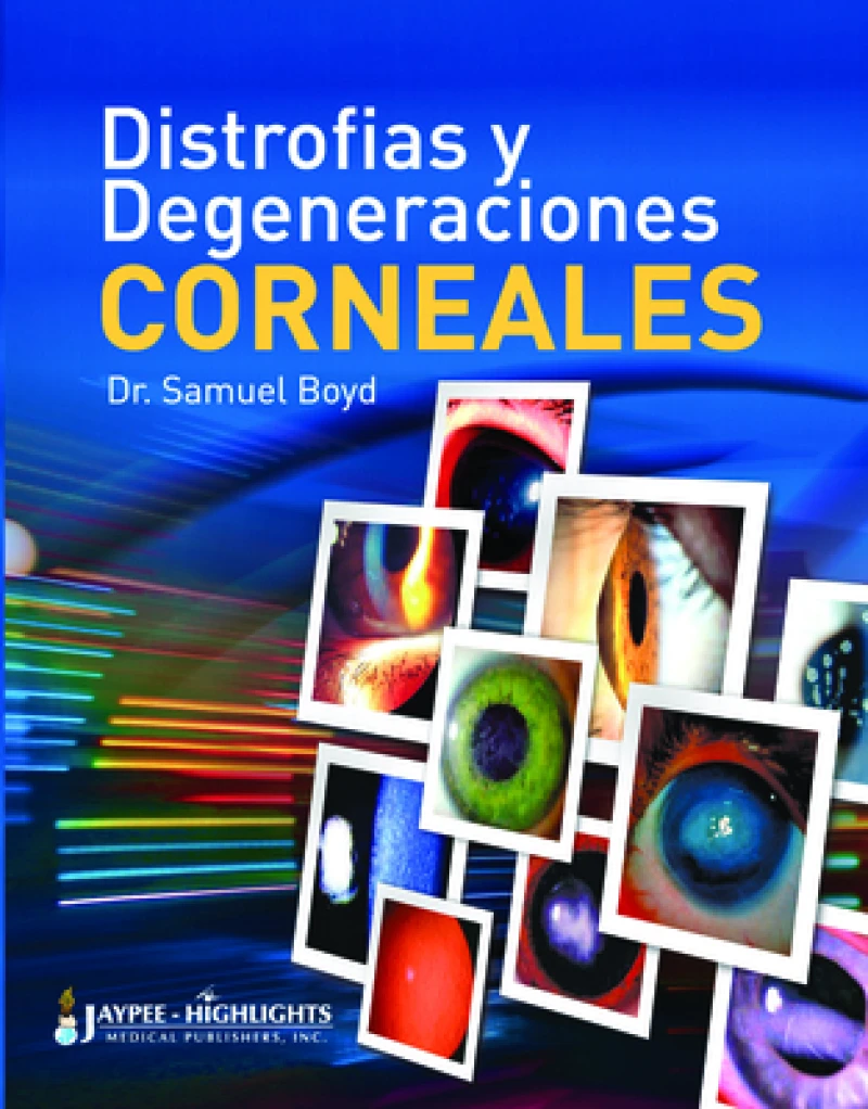 Distrofias y Degeneraciones Corneales